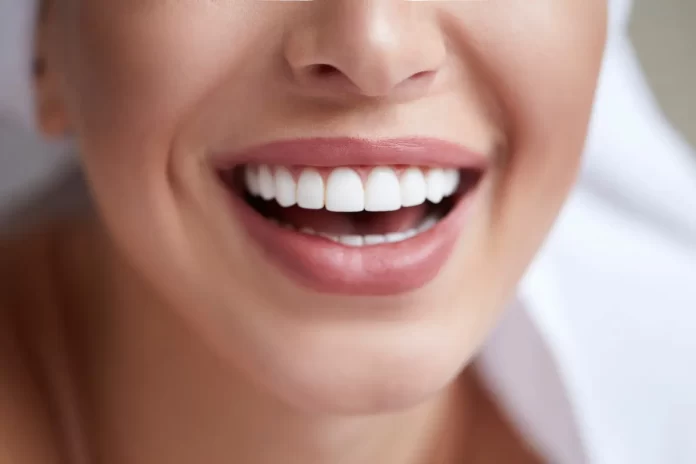 Porcelain Veneers Porcelain Veneers