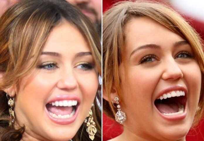 Miley Cyrus Teeth Miley Cyrus Teeth